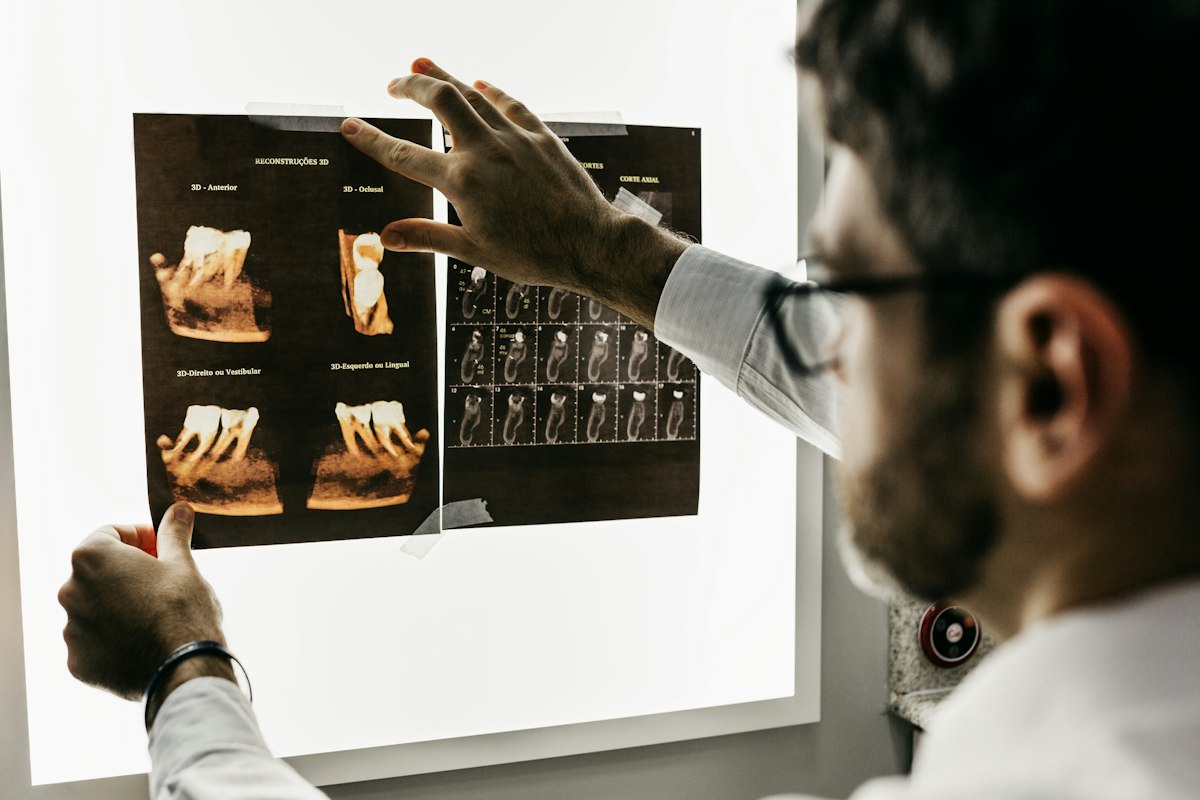 Clinician studying a digital 3D dental scan for denture design